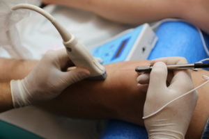 Szkolenie leczenie przezskórną elektrolizą EPTE